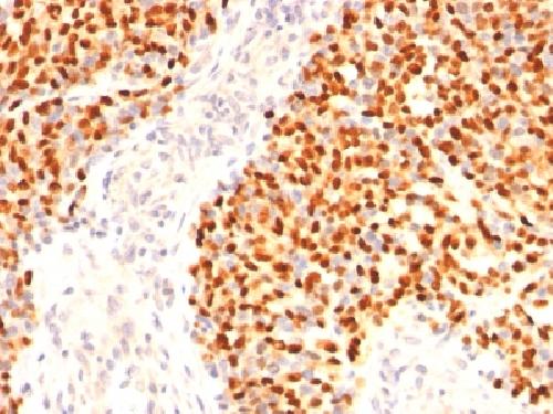 Myogenin / Myf-4 (Skeletal Muscle Marker) Antibody