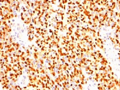 Myogenin / Myf-4 (Skeletal Muscle Marker) Antibody