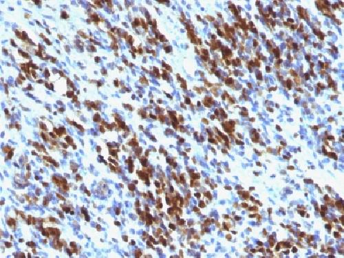 Myogenin / Myf-4 (Skeletal Muscle Marker) Antibody