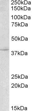 Goat anti-Myogenin / MYF4 Antibody