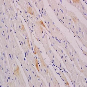 Myogenin Rabbit Polyclonal Antibody