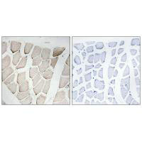 MYOM1 Antibody
