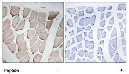 MYOM1 antibody