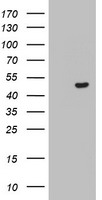 Myoneurin Antibody