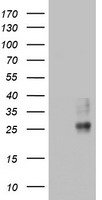 Myoneurin Antibody