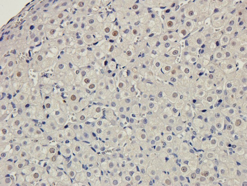 Myosin 3 antibody