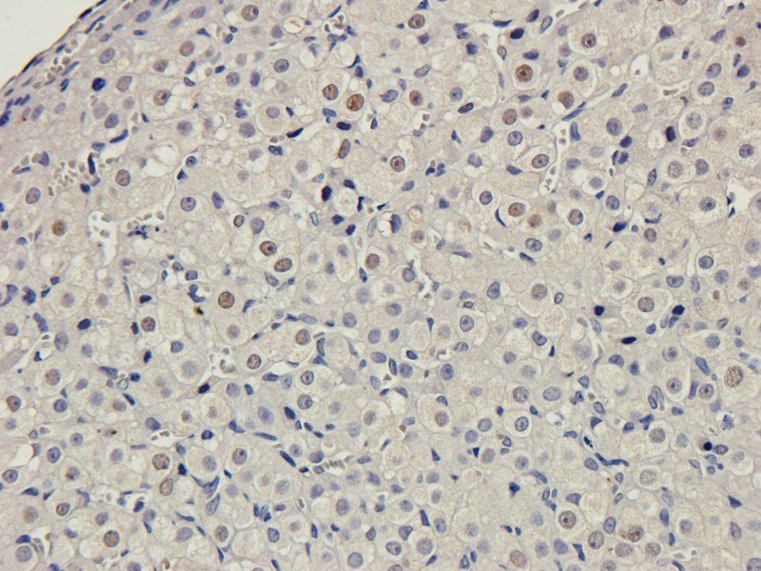 Myosin 3 antibody