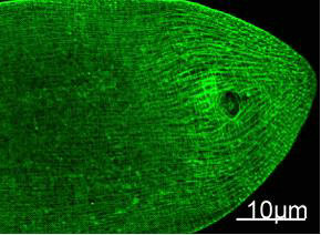 Myosin Heavy Chain antibody