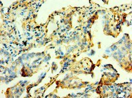 MYOT Antibody