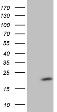 Myotilin (MYOT) antibody