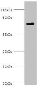 Myotubularin-related protein 7 antibody