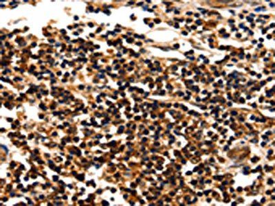 MYOZ1 Antibody