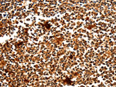 MYOZ1 Antibody
