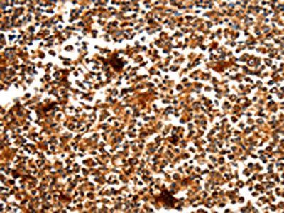 MYOZ1 antibody