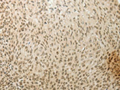 MYSM1 Antibody