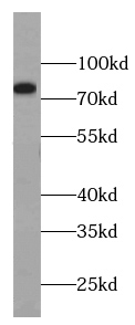 MYSM1-Specific antibody
