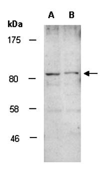 MYST2 antibody