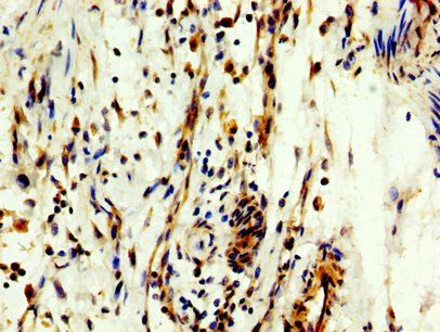 MYT1 Antibody