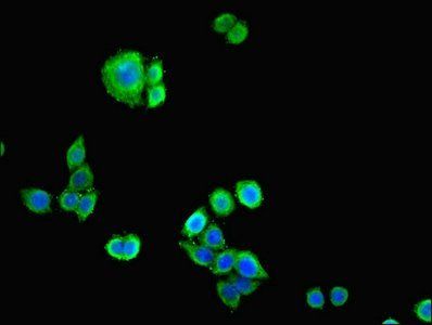 N Cadherin antibody