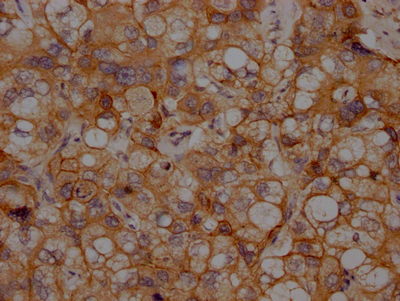 N Cadherin antibody