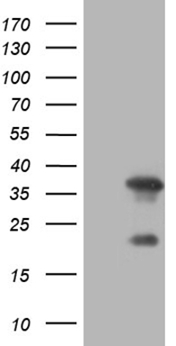 n-Myc (MYCN) antibody