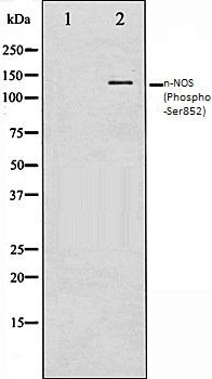 n-NOS (Phospho-Ser852) antibody