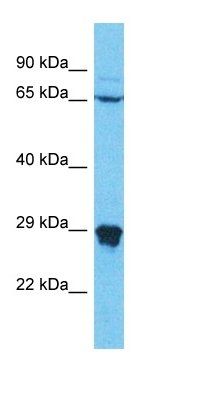 N4BP2L1 antibody