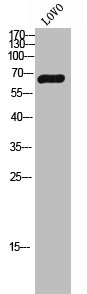 N4BP2L2 antibody