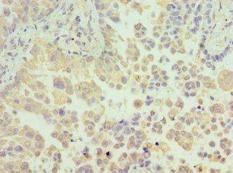N6AMT1 Antibody