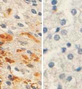 N-acetylglucosaminyltransferase V Rabbit Polyclonal Antibody