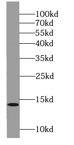 NA14 antibody