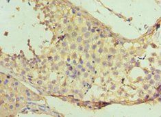 NAA10 Antibody