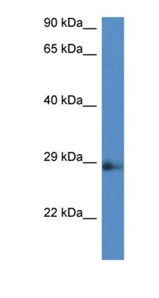Naa11 antibody