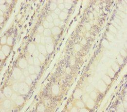 NAA25 Antibody