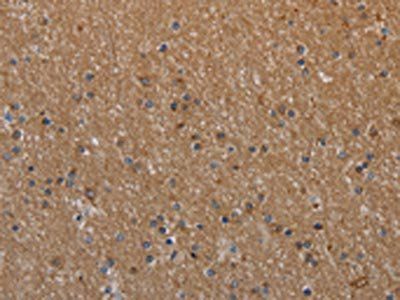 NAA25 Antibody