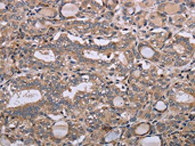 NAA25 Antibody