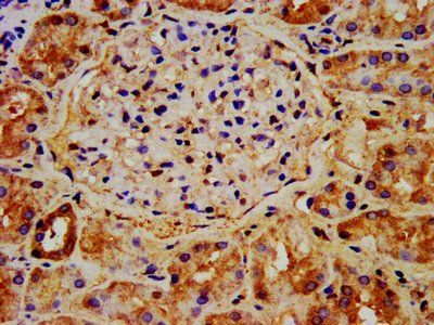 NAA38 Antibody