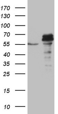 NAB1 antibody