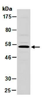 NAB1 antibody