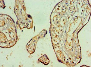 NAB2 antibody