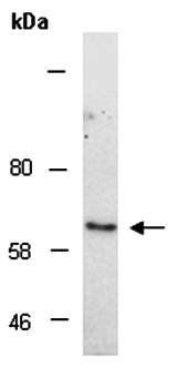 NAB2 (M1) Antibody, Rabbit Polyclonal