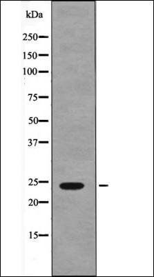 NACA (Phospho-Ser43) antibody