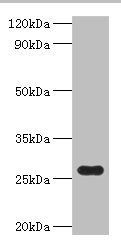 NAD(P)H-flavin reductase antibody