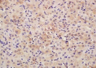 NADE antibody