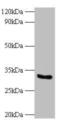 NADH-cytochrome b5 reductase 3 antibody