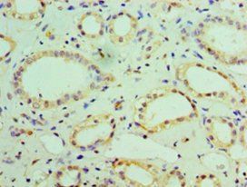 NDUFB7 Antibody