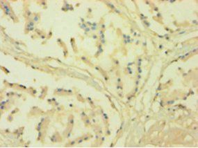 NADPH-cytochrome P450 reductase antibody