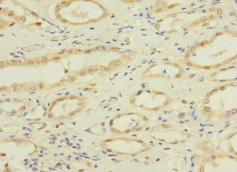 NAE1 Antibody