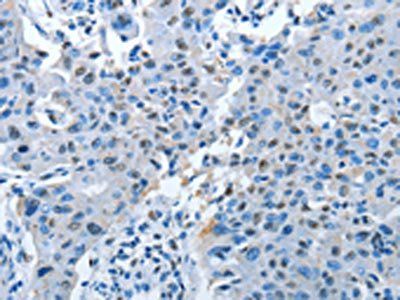 NAE1 Antibody