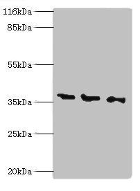 NAGK antibody